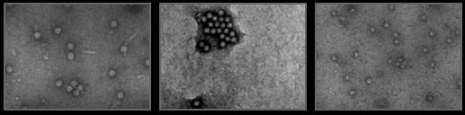 Electron micrograph of a virus