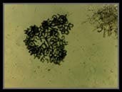 Anabaena
