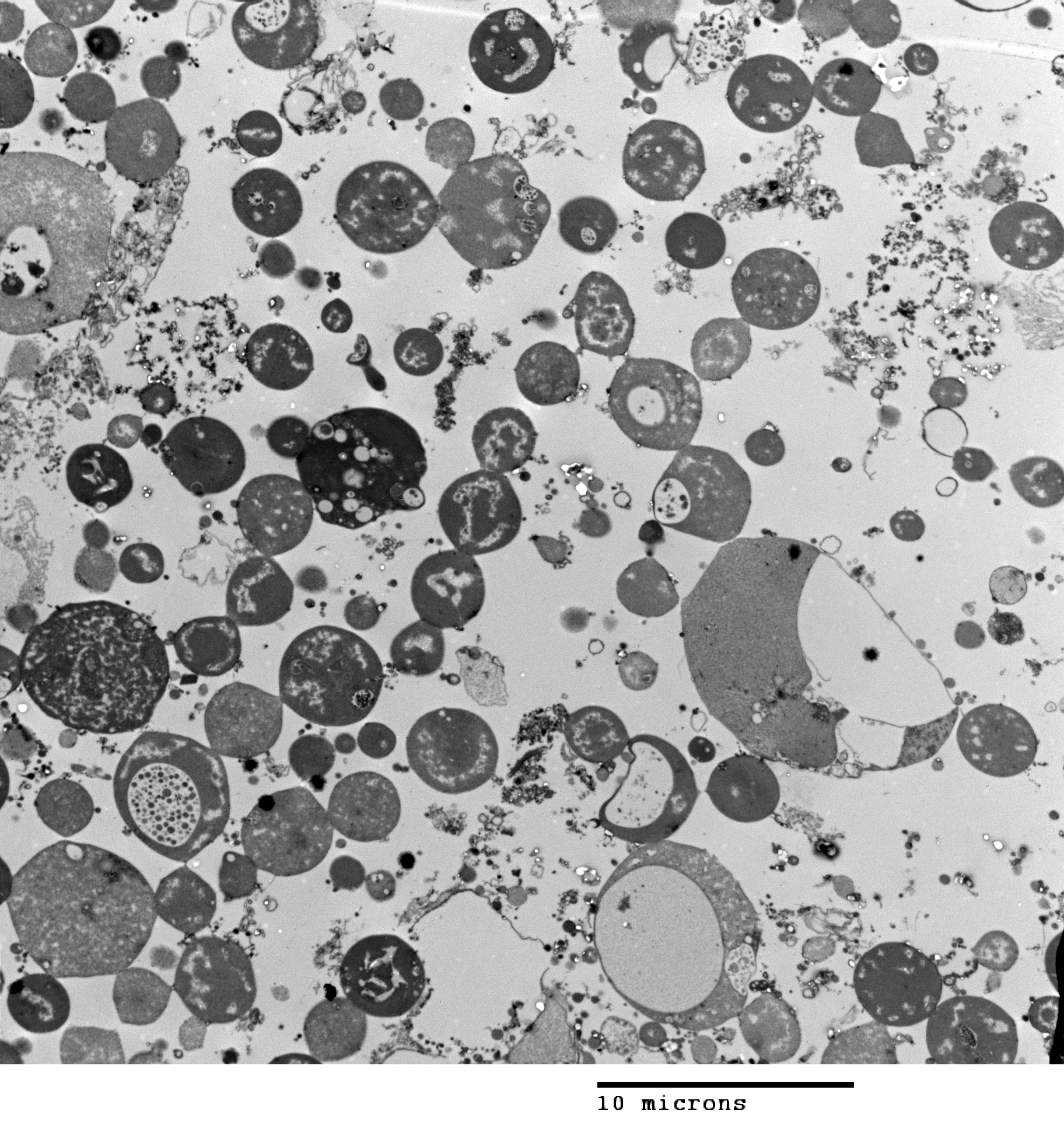 All bacteria are prokaryotes